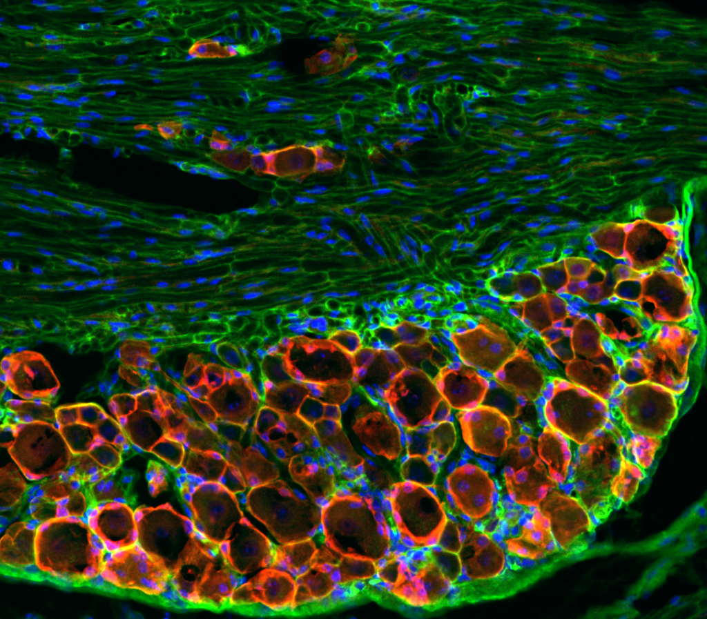 Spinning-disk confocal image of a mouse dorsal root ganglion section showing blue nuclei (DAPI), red satellite glial cells (FABP7), and green glial cells and Schwann cells (GFAP).