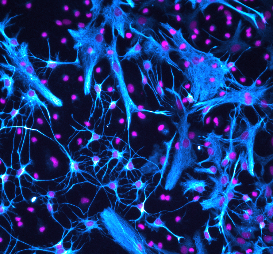 Widefield fluorescence image of spinal cord cultures showing astrocytes with different morphologies in cyan (GFAP) and nuclei in magenta (DAPI).