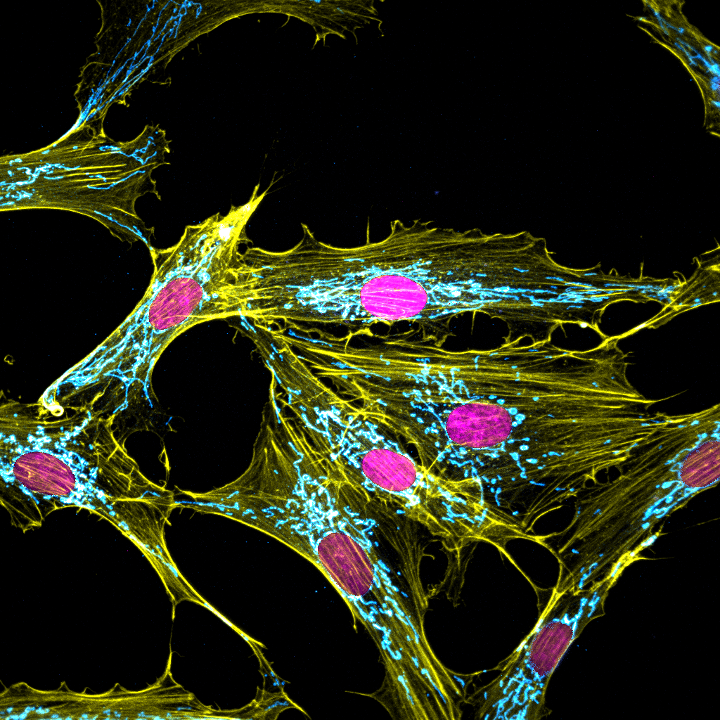 Confocal maximum projection image of mesenchymal stem cells showing cyan mitochondrial networks (TOM20), yellow actin cytoskeleton, and magenta nuclei (DAPI).